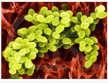 微生物降解技術